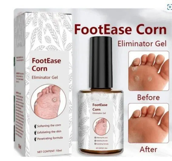 FootCare™ Corn & Hard Skin Removal Serum – Intensive Foot Care | 30ml